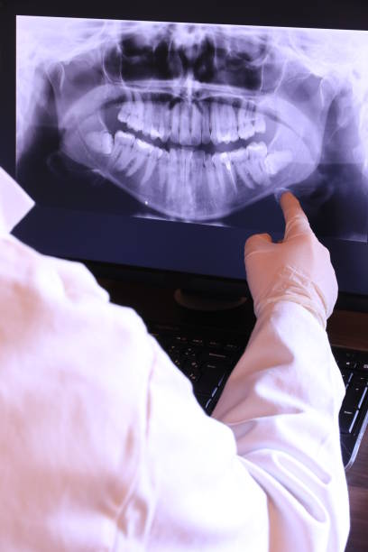 Best Emergency Dental Care for Broken or Chipped Teeth in Green Oaks, IL