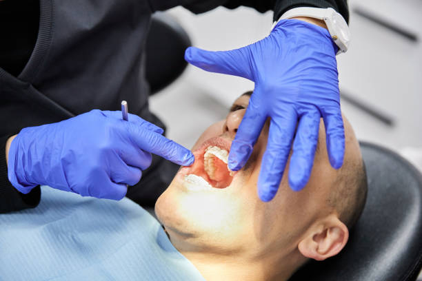 Best Emergency Tooth Extraction in Green Oaks, IL
